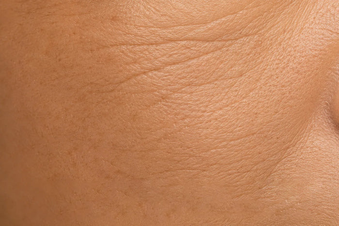 Anti-Ageing